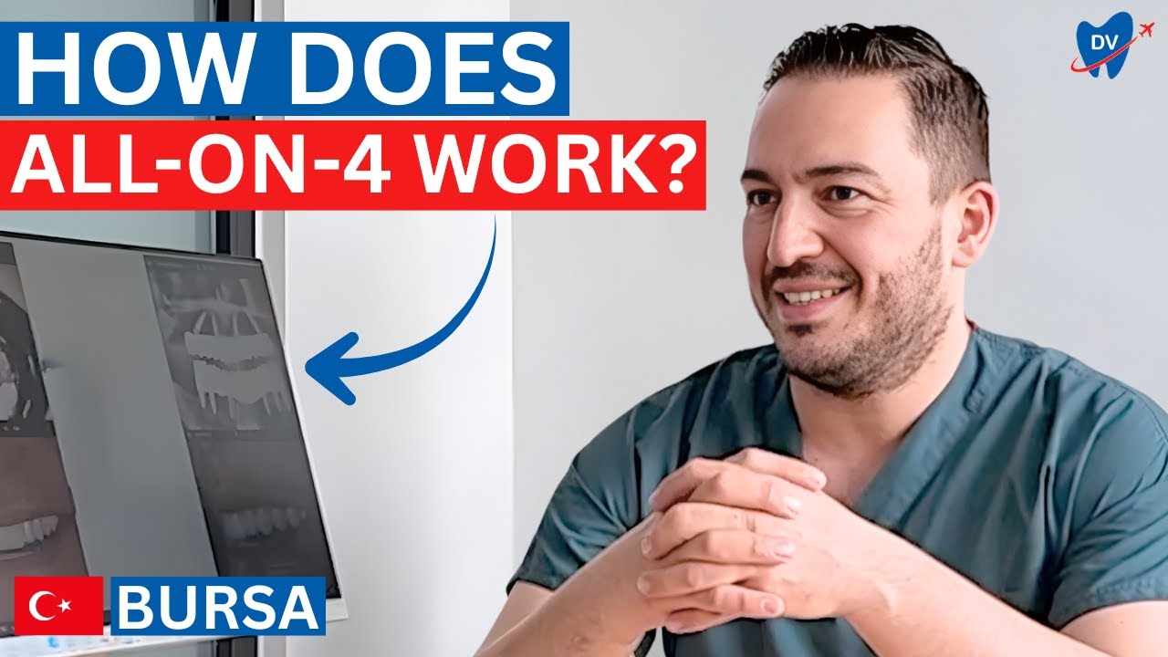 All-on-4 Dental Implants in Bursa: 98% Success Rate for Full-Mouth Restorations in Turkey