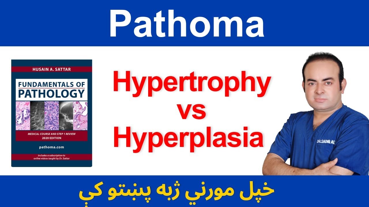 Hypertrophy VS Hyperplasia | Dr. Sadiq Ali