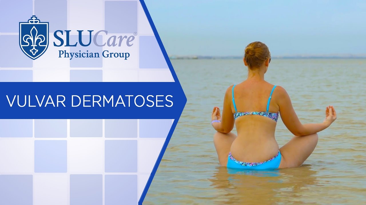Treating Vulvar Dermatoses at SLUCare Dermatology
