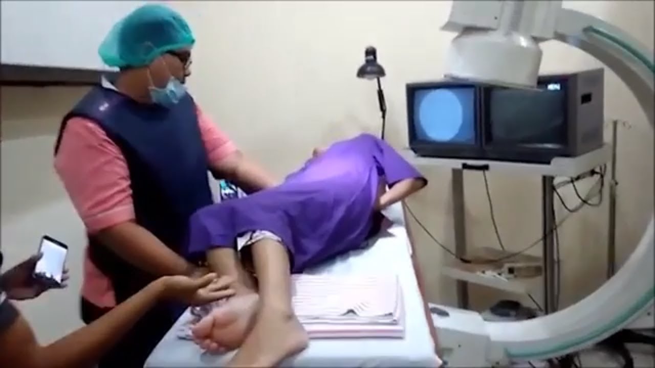 Nyeri Pinggang Langsung Hilang dengan Radio Frekuensi Ablasi