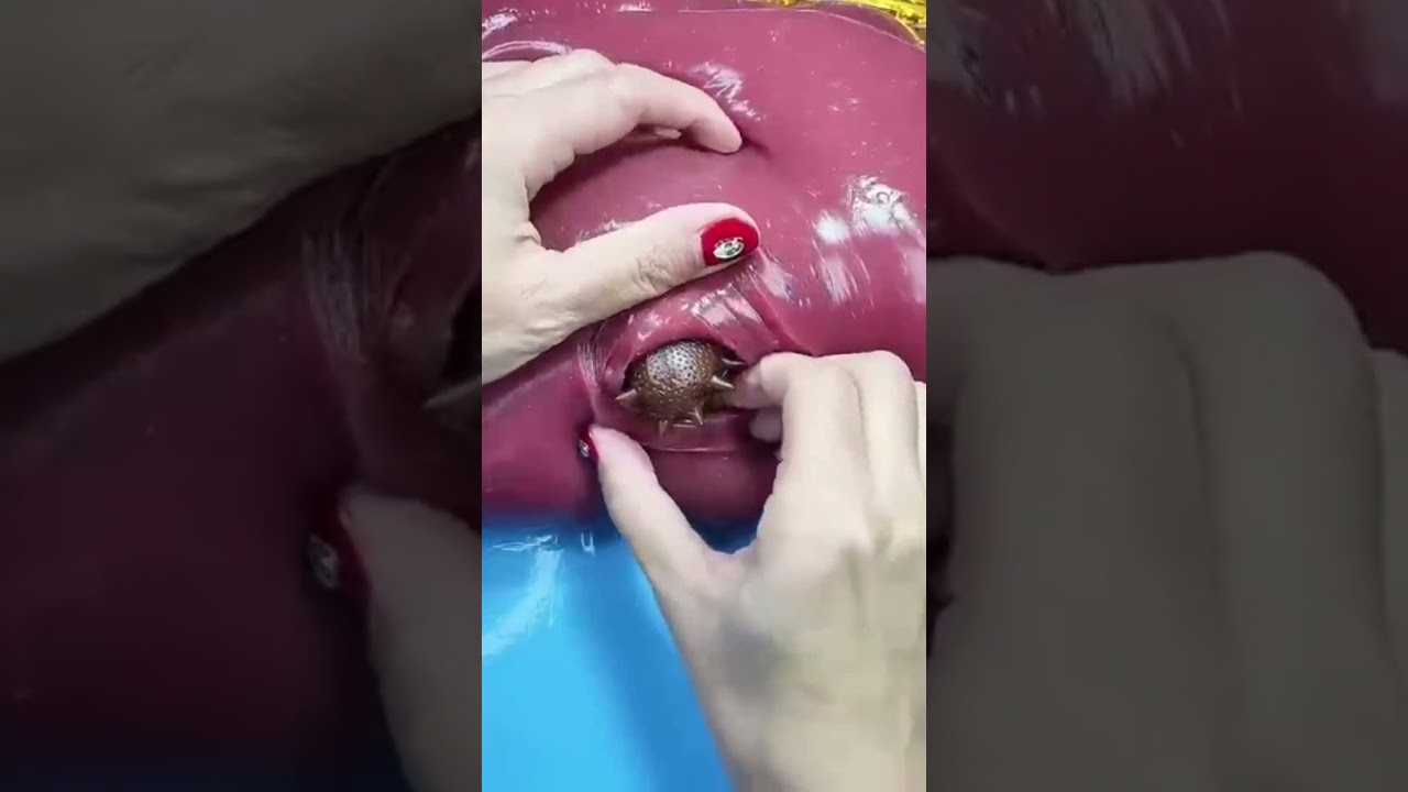 Przecięła silikon&hellip; aw środku znaleziono coś zupełnie niespodziewanego!😳🔪