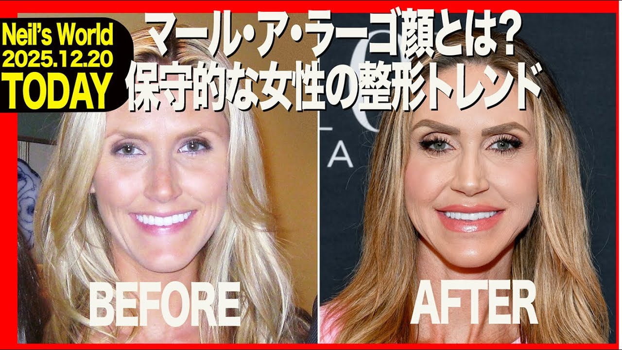 マール・ア・ラーゴ顔とは？保守的な女性の整形トレンド AMERICA TODAY 20251220
