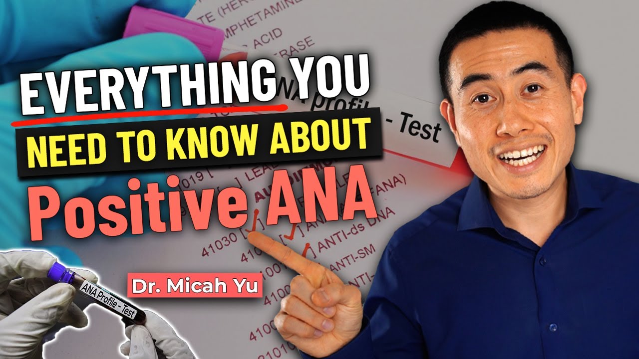 I have a positive ANA test, NOW WHAT? Rheumatologist Explains