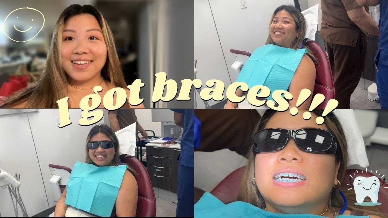 Getting braces vlog!!! :)