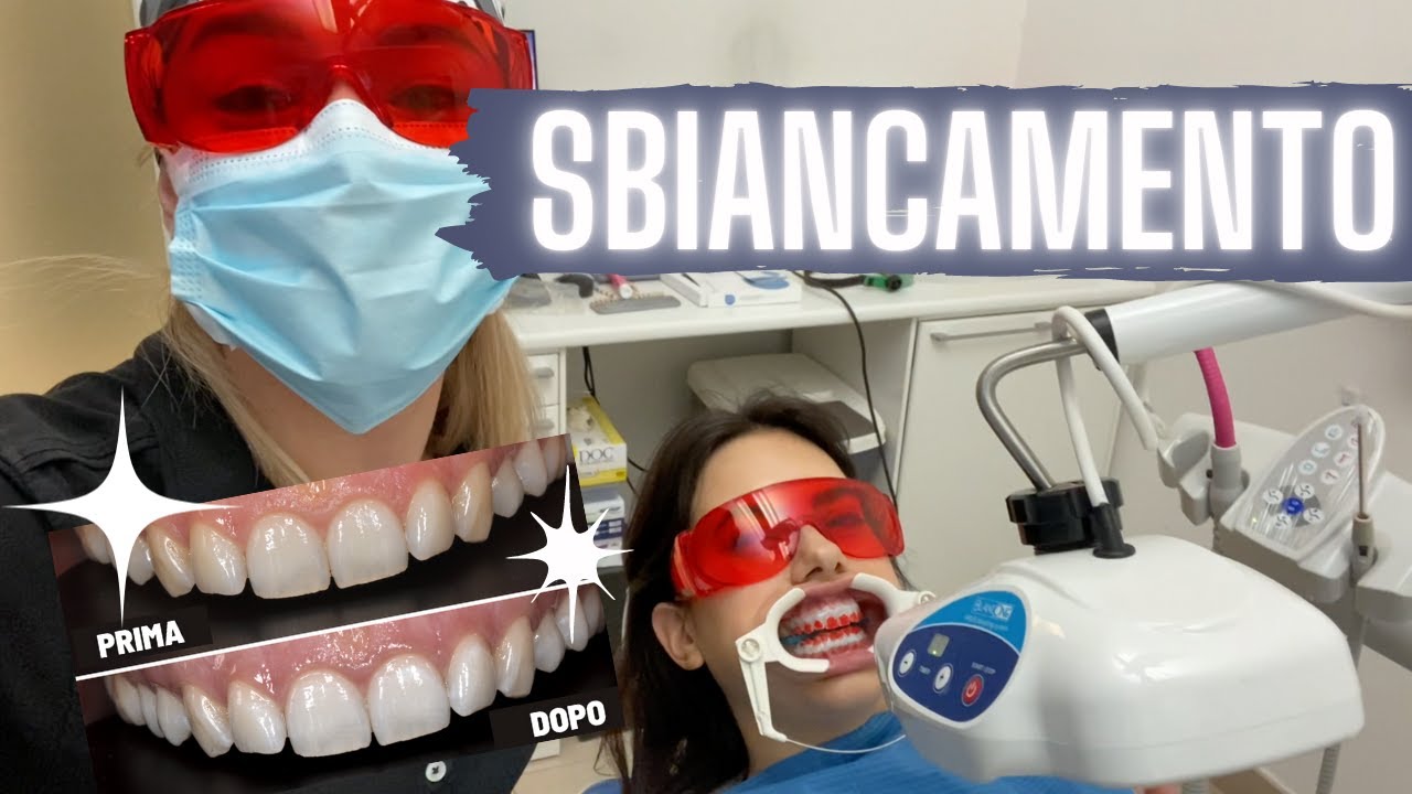 SBIANCAMENTO dei DENTI in studio - Prima e Dopo e intervista a Jasmine