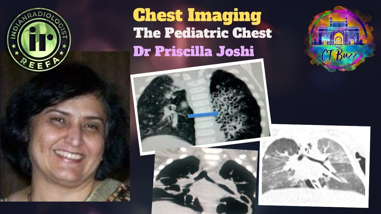 Dr Priscilla Joshi | The Pediatric Chest #ctbuzz #medicalimaging