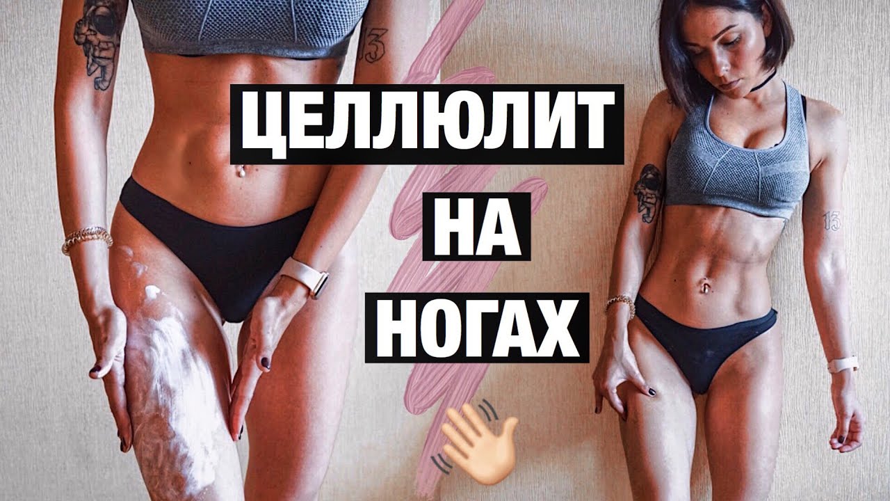 ЦЕЛЛЮЛИТ НА НОГАХ! КАК УБРАТЬ? МОЯ ИСТОРИЯ БОРЬБЫ С ЦЕЛЛЮЛИТОМ ЭТИМ ЛЕТОМ 😫