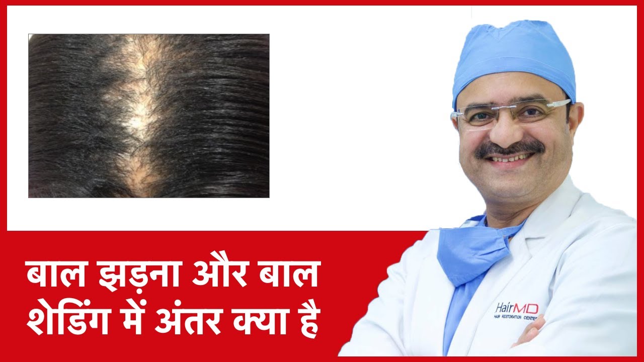 Hair Loss vs Hair Shedding (बाल झड़ना और बाल शेडिंग में अंतर क्या है) | HairMD, Pune | (In HINDI)