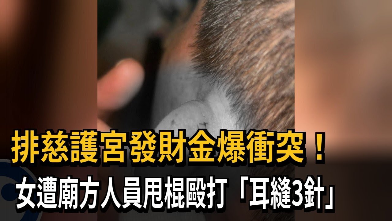 排發財金爆衝突！ 女遭廟方人員甩棍毆打「耳縫3針」－民視新聞