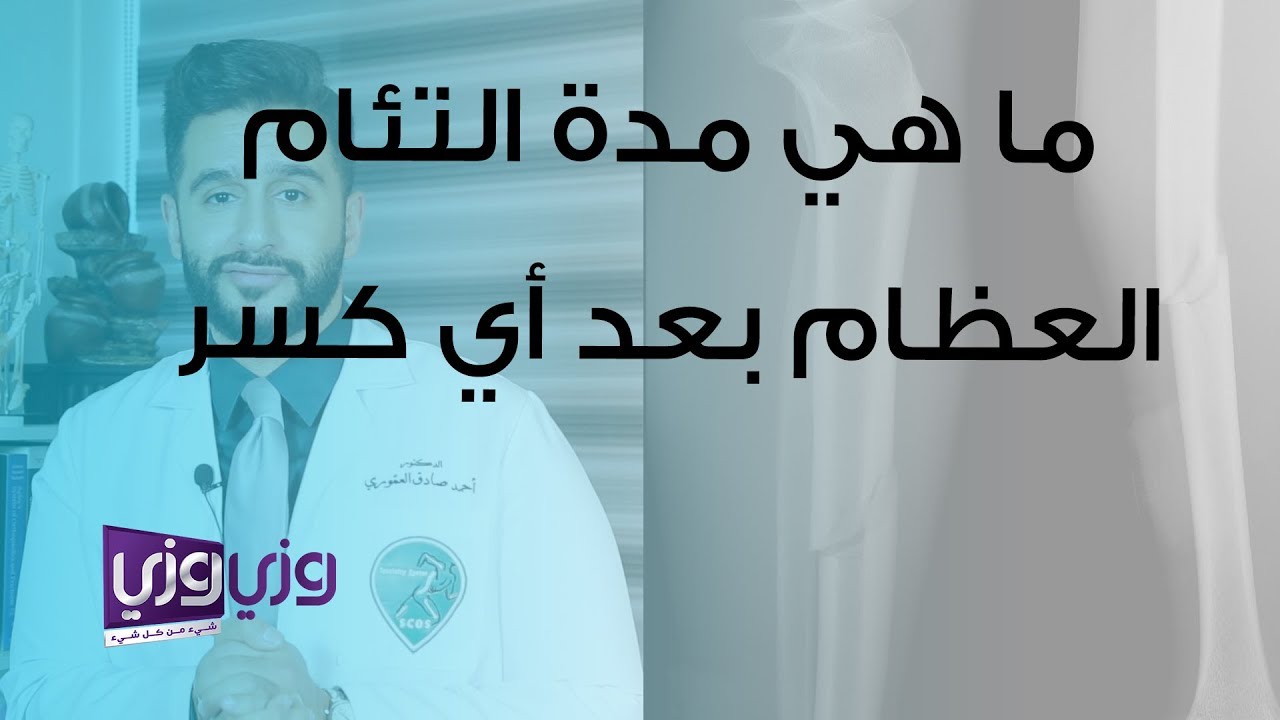 ما هي مدة التئام العظام بعد أي كسر