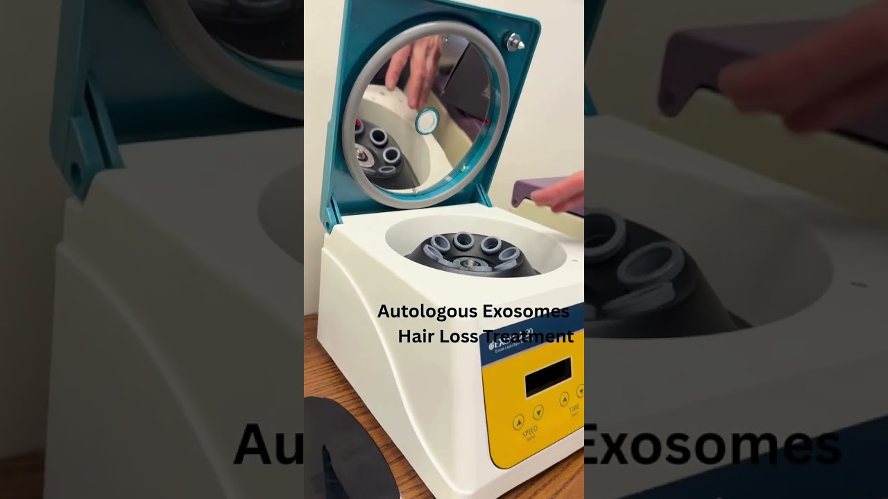 🔬 Autologous Exosomes for Hair Loss | Cellarich Exosome Therapy at Freedom Clinic Toronto