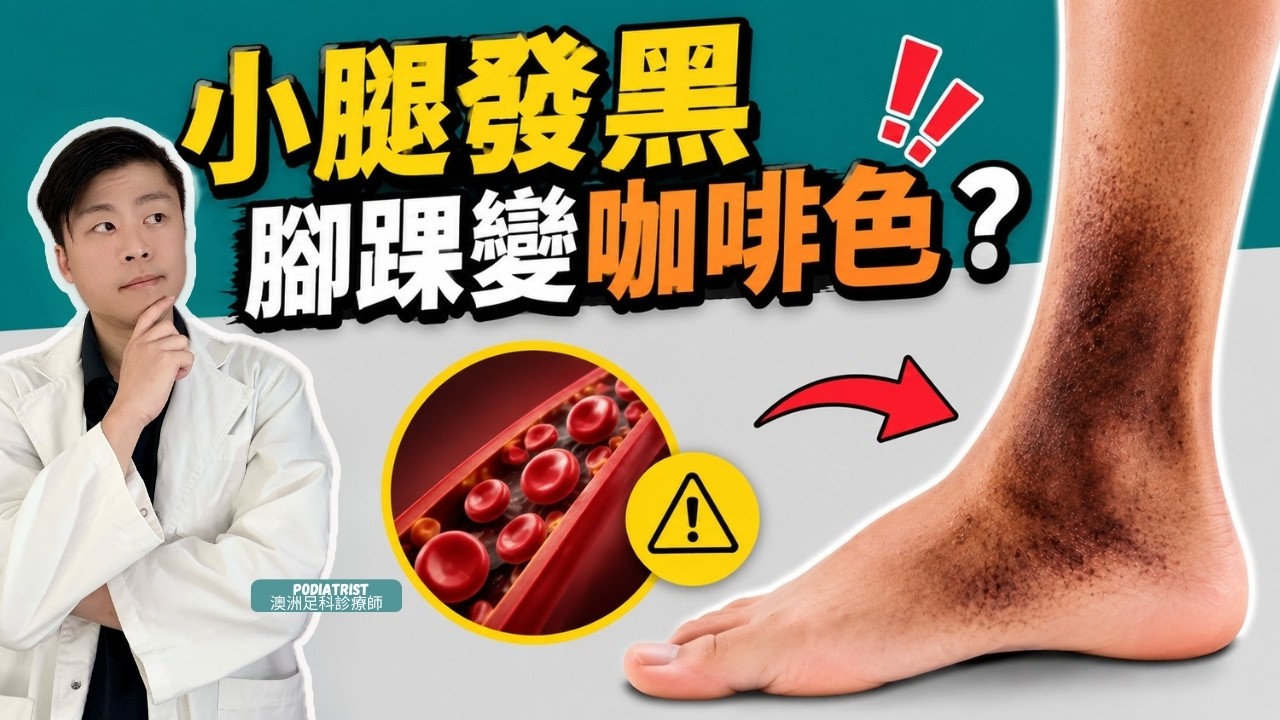 小腿發黑、腳踝變咖啡色？小心是血鐵質沉著＝血液循環出問題