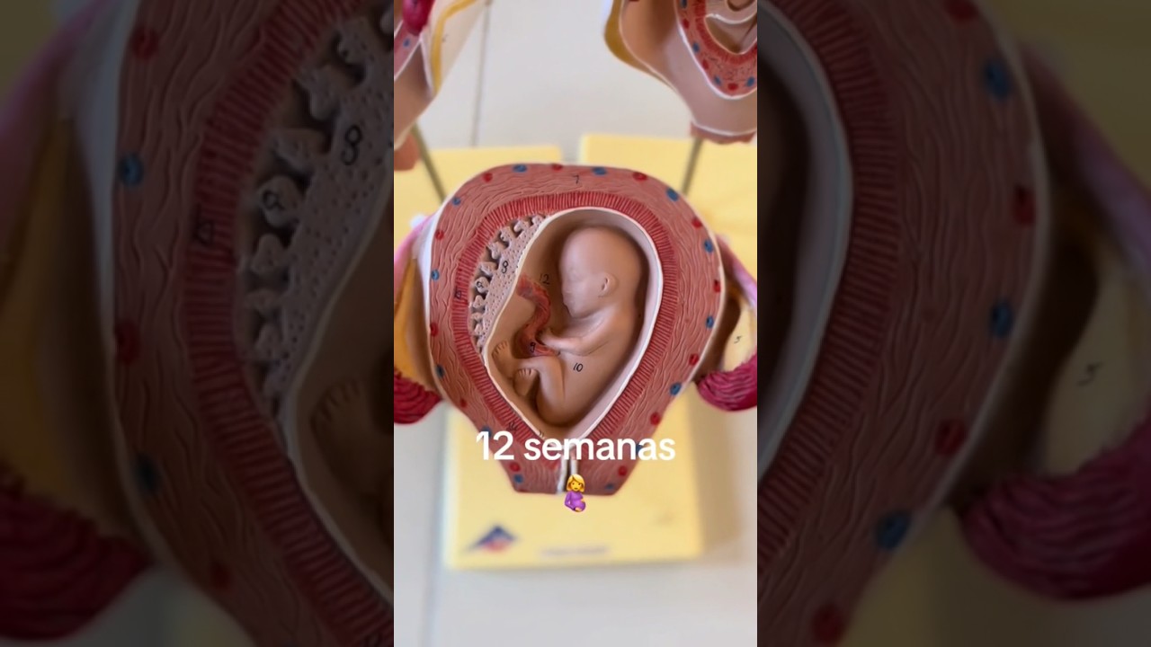 12 semanas. #medicina #ecografia #bebe #ginecologia #obstetricia #embarazofeliz