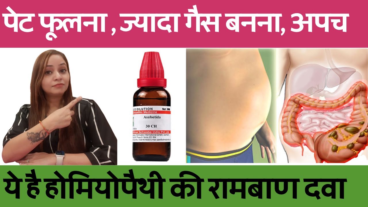 पेट फूलना और ज्यादा गैस बनना | होमियोपैथी की बेस्ट दवा | homeopathy for indigestion, gas, acidity