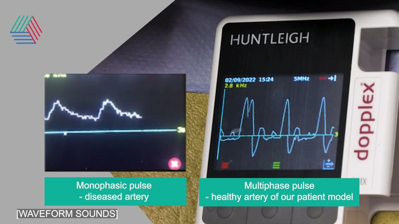 9 nhs peripheral vascular assessment  femoral pulse check