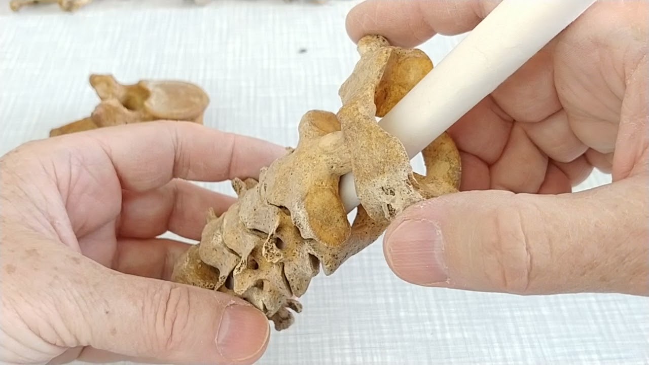 Anatomia w pigułce. Kości szkieletu osiowego. Cz. 2 - Kręgosłup.