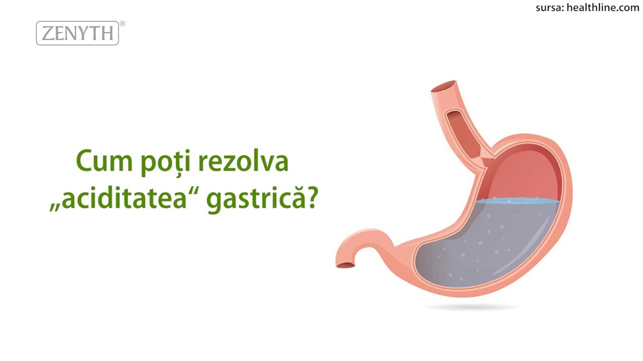 Cum poți rezolva ”aciditatea” gastrică?