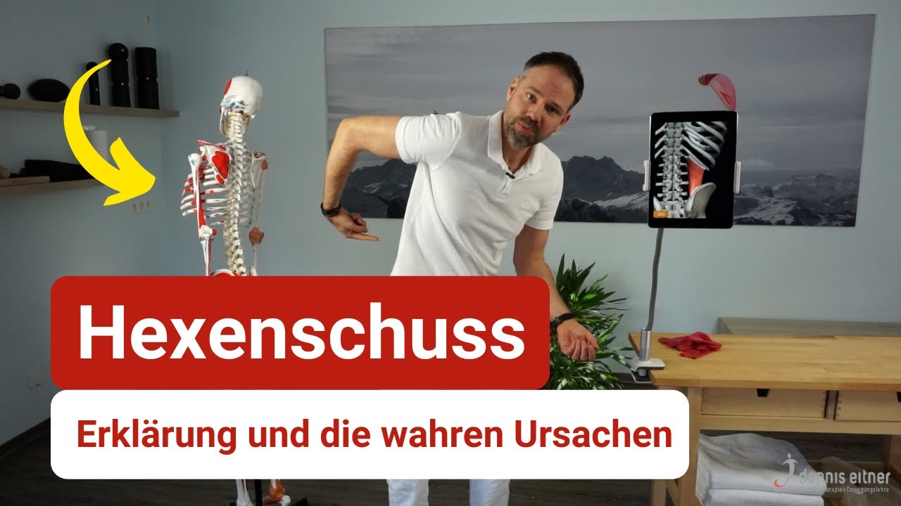 Hexenschuss erklärt - Das ist die wahre Ursache ⚡