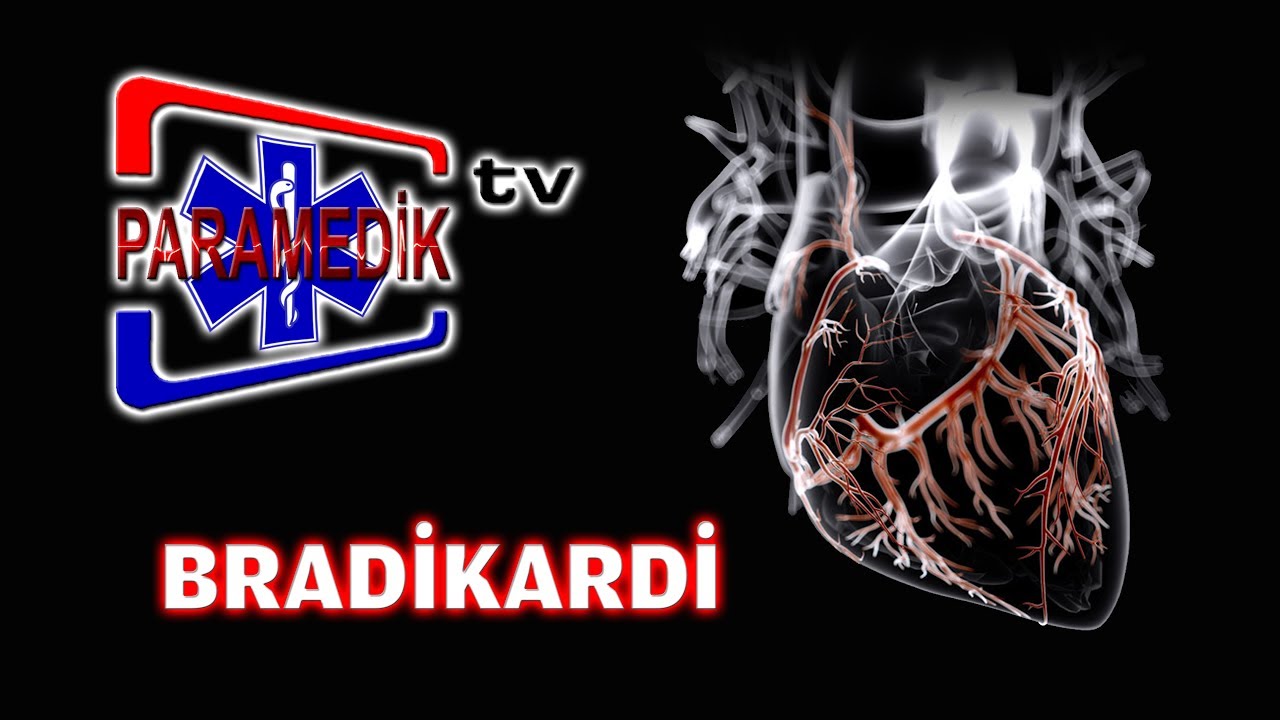 KONU 2: BRADİKARDİ'de Transkutanöz Pace-Maker Uygulaması Nasıl Yapılır ?