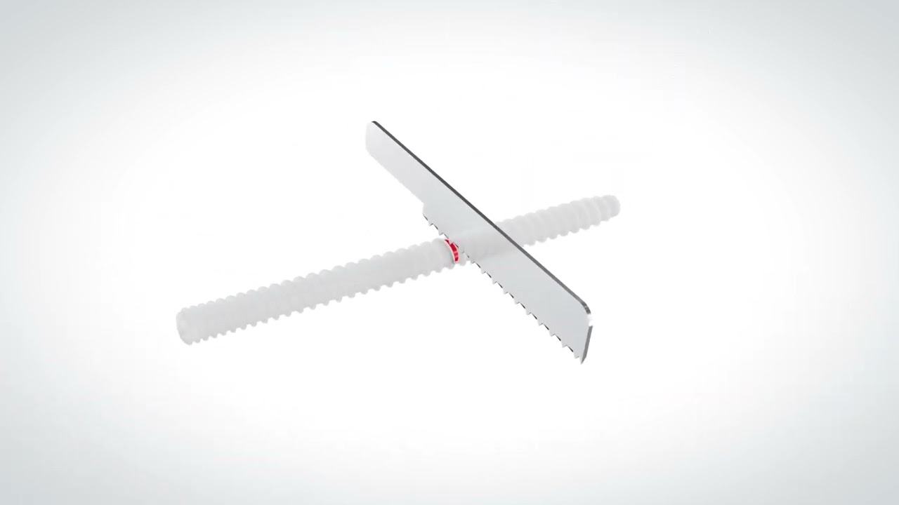 OSSIOfiber® Threaded Trimmable Fixation Nail - Metacarpal Technique