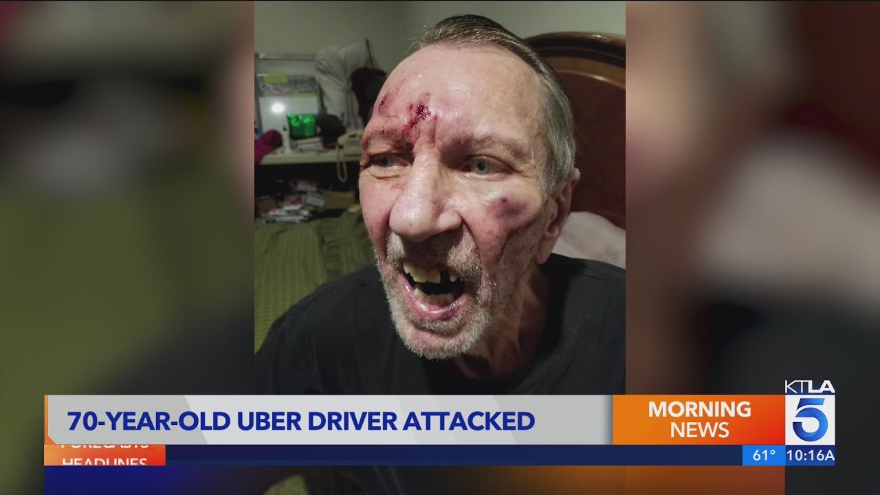 70-year-old Uber driver brutally beaten by passenger in Los Angeles&nbsp;