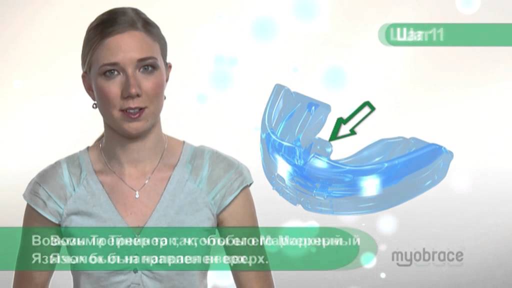 Инструкции по применению и ношению Трейнер и Myobrace
