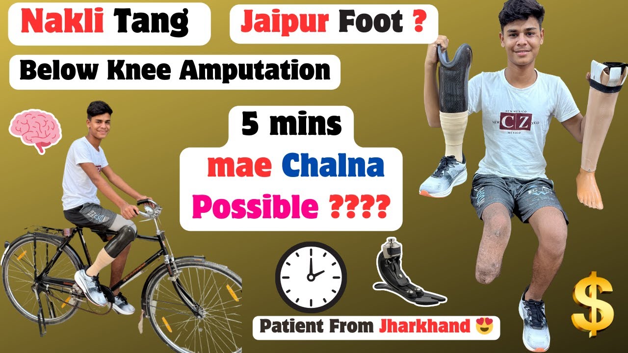 🫵Below Knee Amputation | Ossur Foot Price | Jaipur Foot | Proflex XC | Aspire Liner | #ossur #3r80