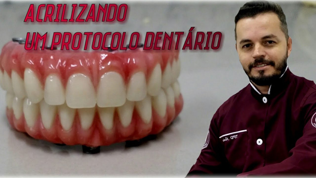 Acrilização de um protocolo dentário / mandíbular