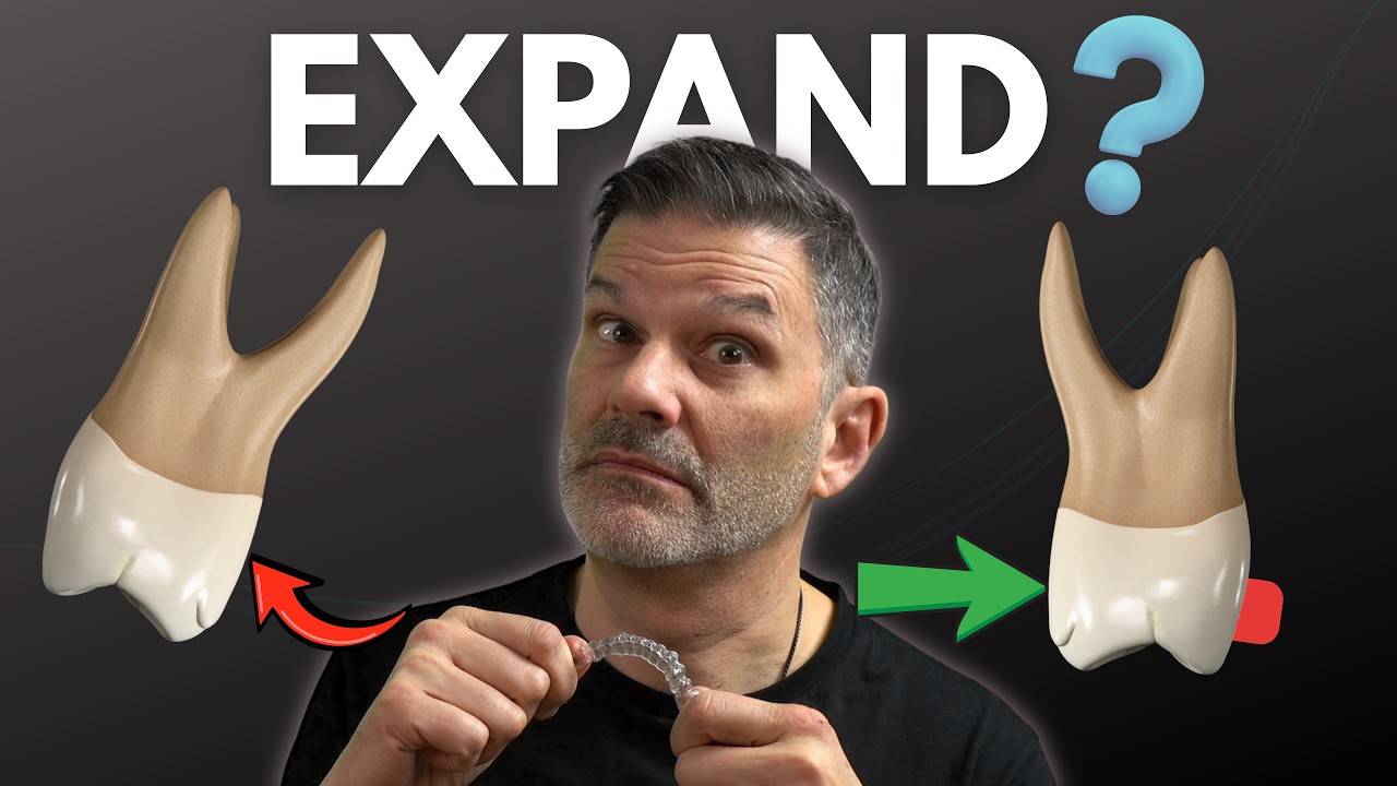 The problem with expansion using clear aligners like Invisalign... and how to fix it!