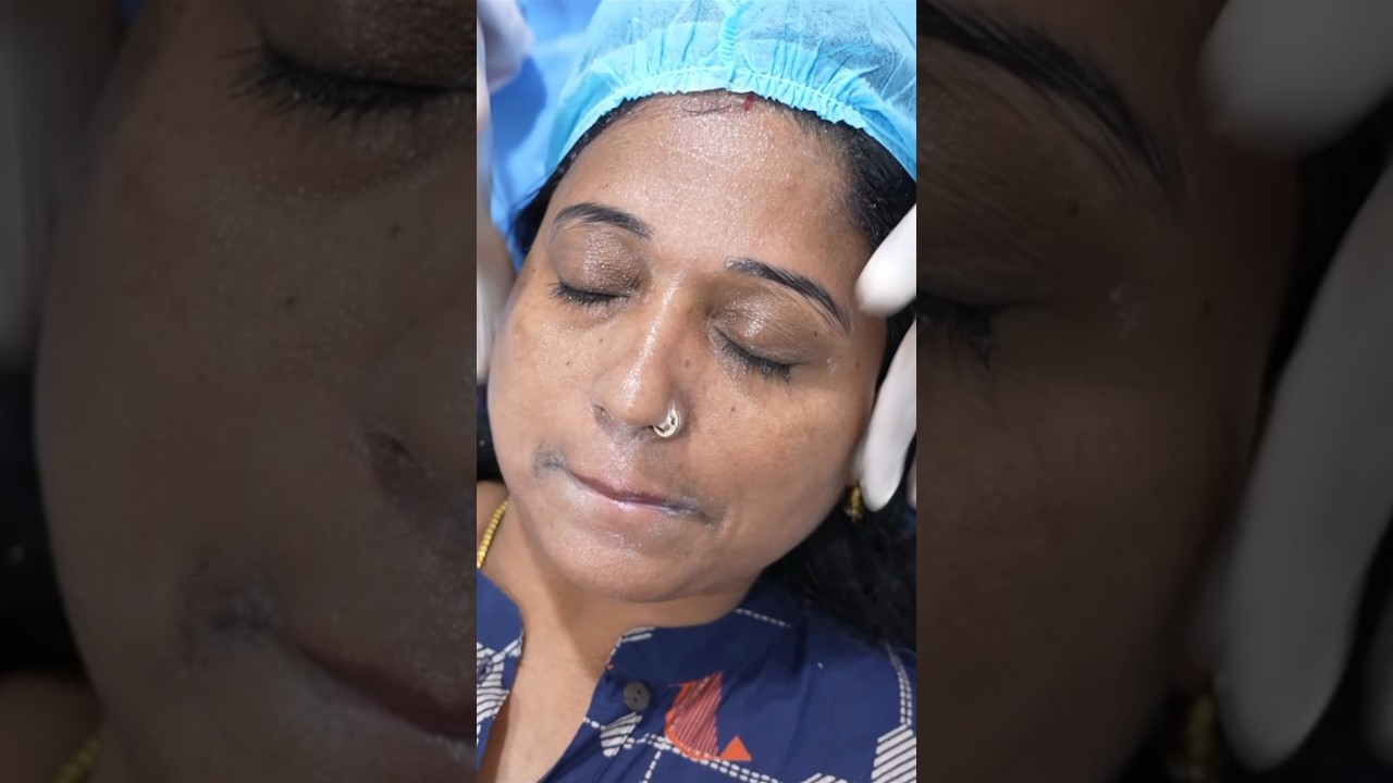 Желтый пилинг для кожи против старения