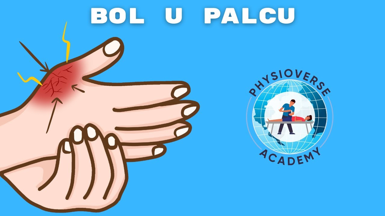 Riješite BOL u PALCU u 3 minute! | Physioverse Academy