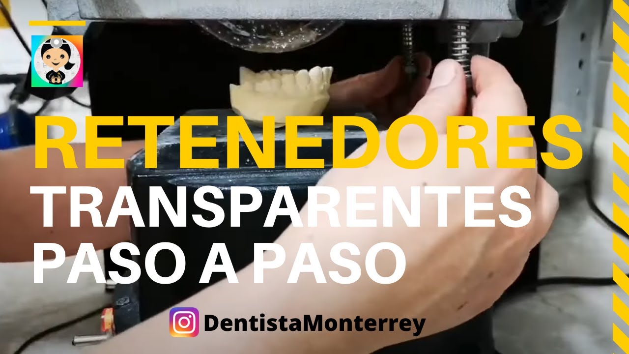 COMO HACER RETENEDORES TRANSPARENTES  👅 PASO a PASO #dental