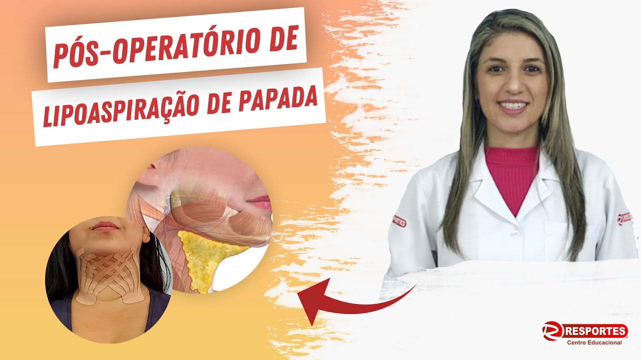 TAPING NA ESTÉTICA:  Pós-Operatório de LIPOASPIRAÇÃO DE PAPADA