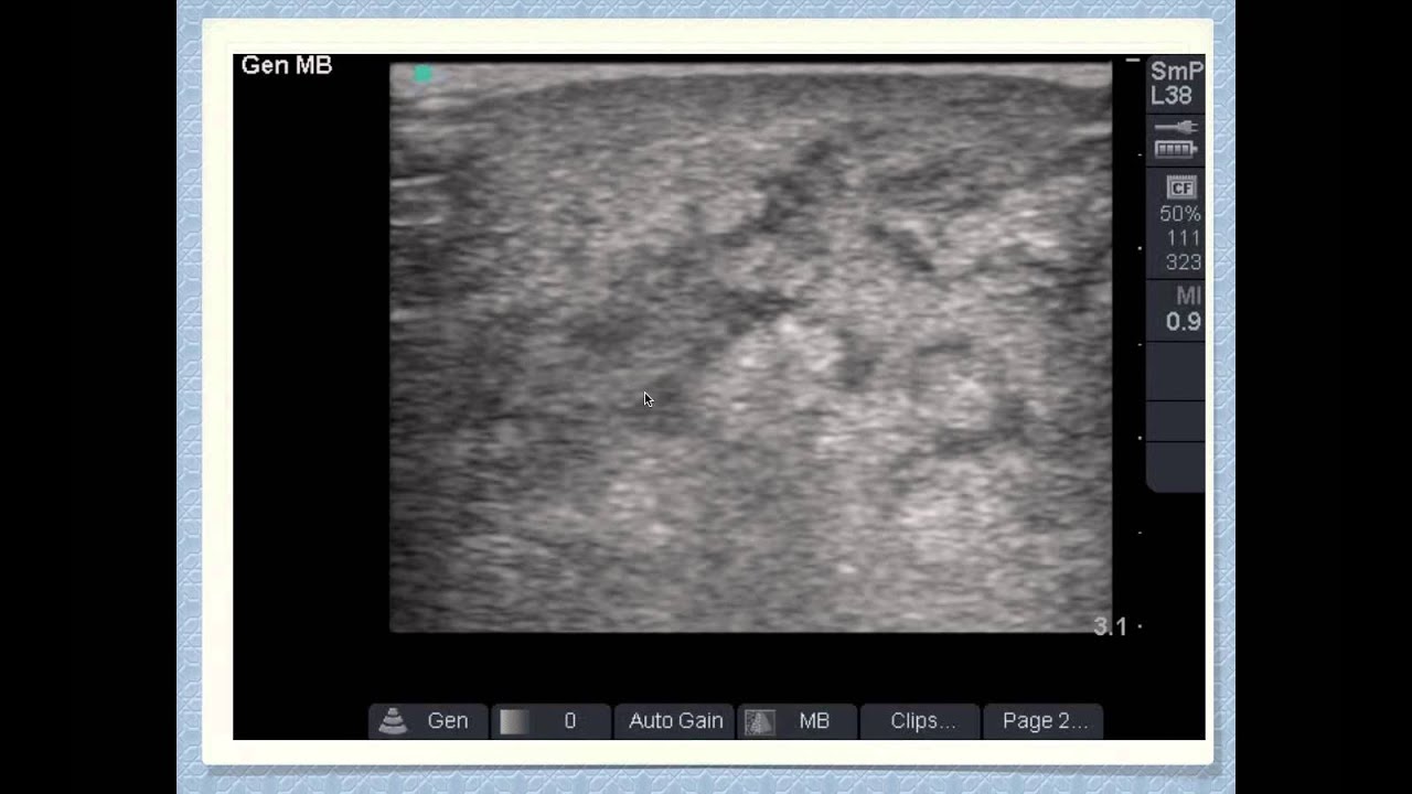 Soft Tissue