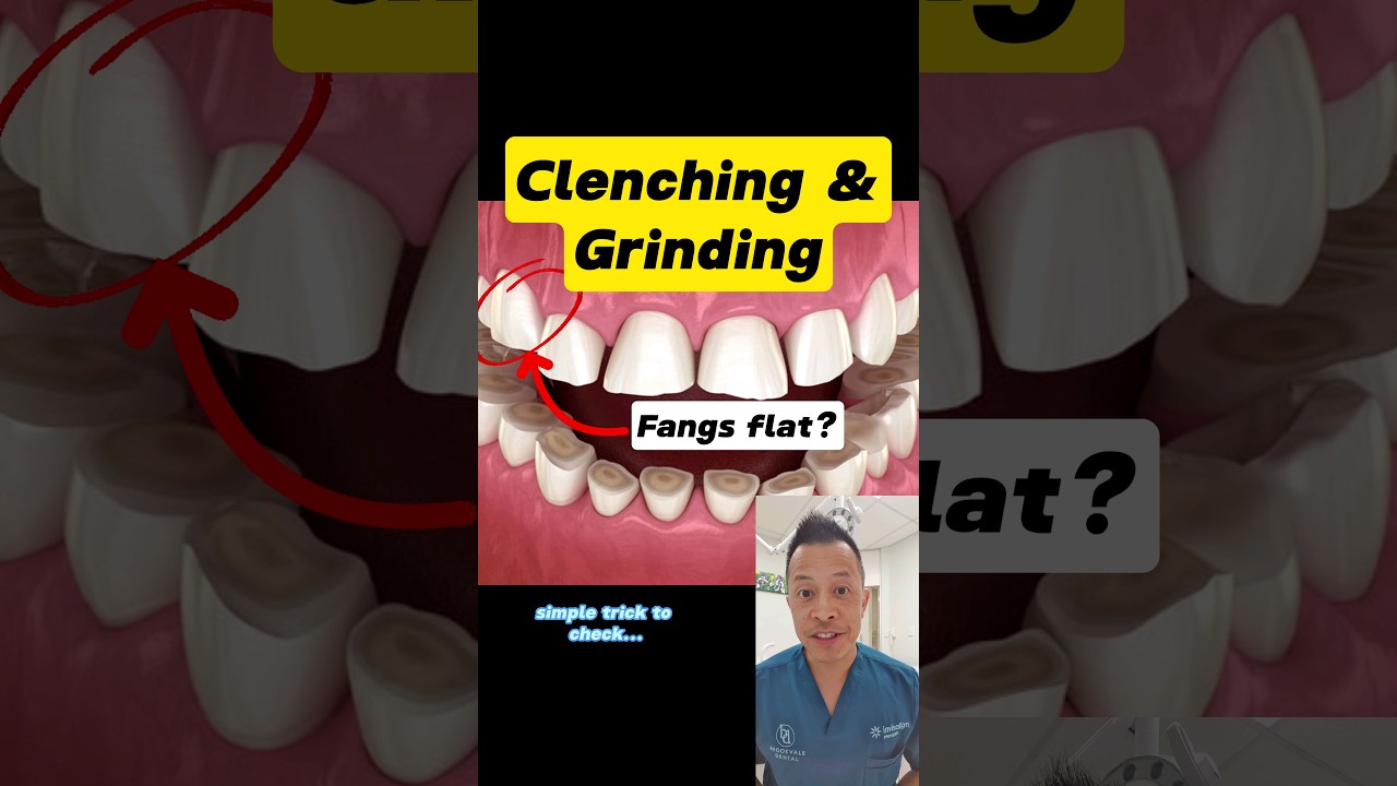DIY Bruxism Assessment: 10 Second Test for Clenching or Grinding Teeth! #shorts #dentallan #dentist