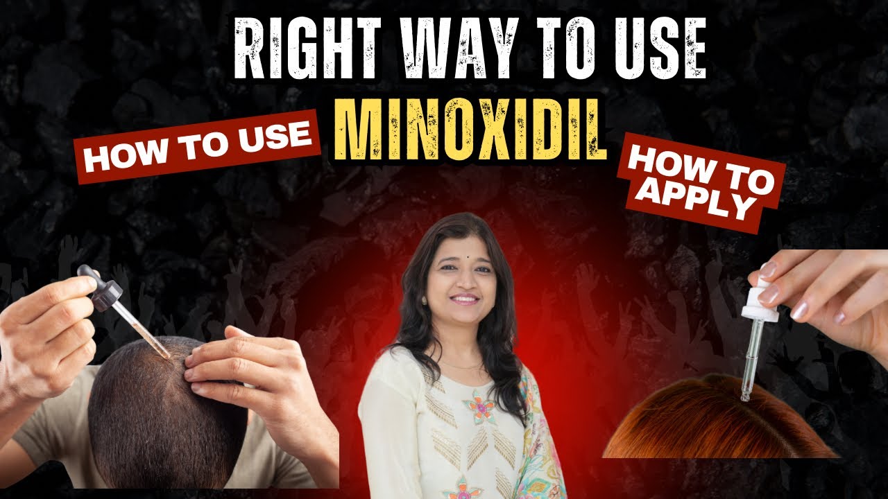 Correct way to use minoxidil in 2025 | minoxidil 5% ka use kaise Kare? | minoxidil for thinning hair
