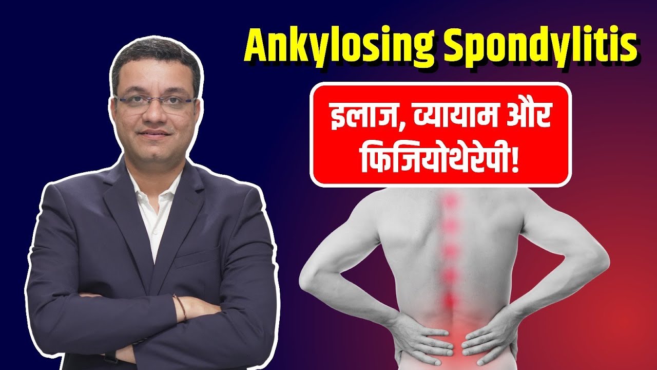 एंकायलोसिंग स्पॉन्डिलाइटिस का इलाज & फिजियोथेरेपी के फायदे | Treatment of Ankylosing Spondylitis