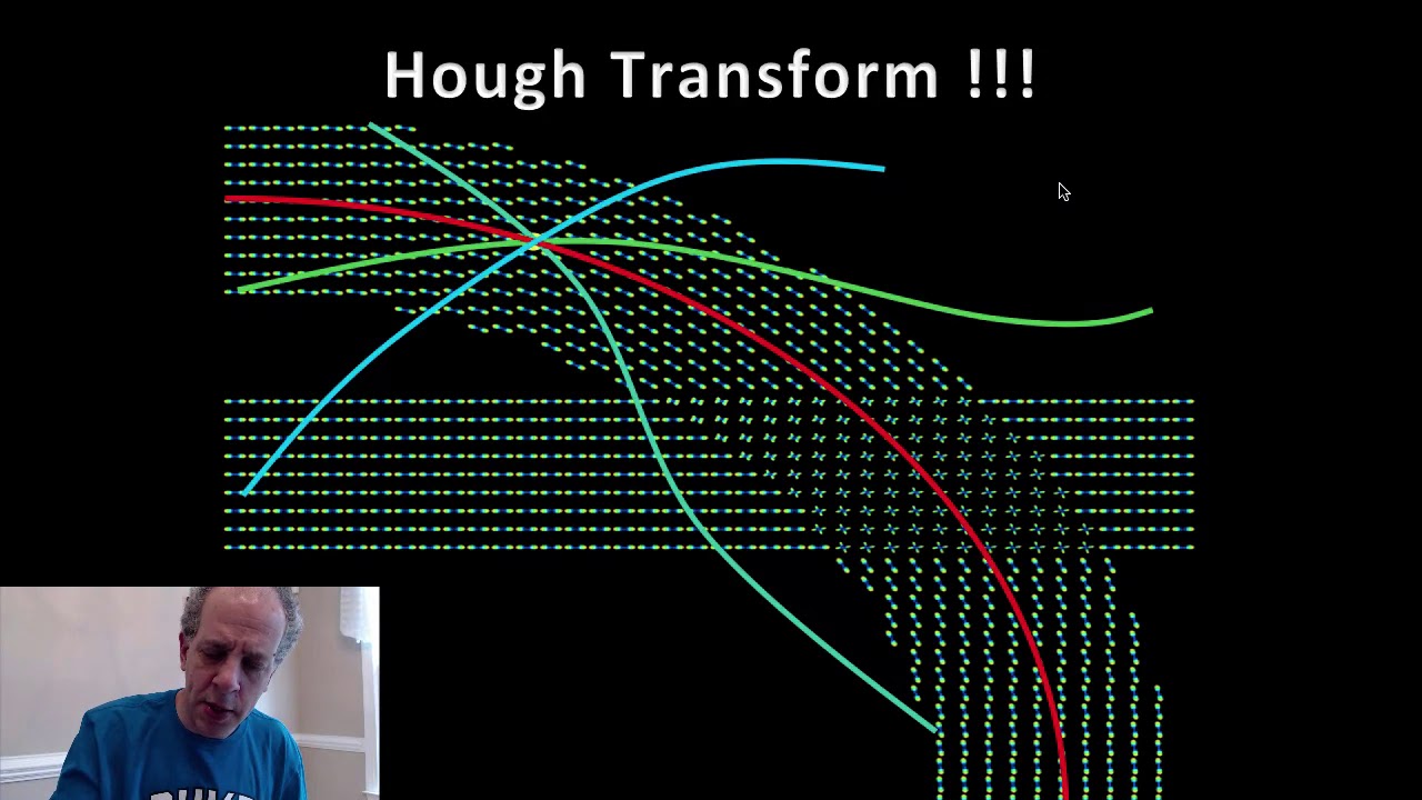 3   Brain Imaging, Diffusion Imaging, Deep Brain Stimulation