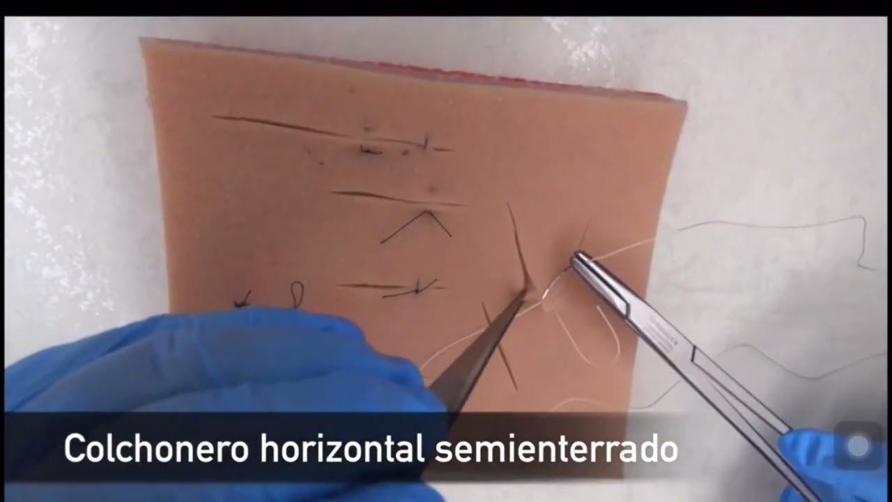 Colchonero horizontal semienterrado