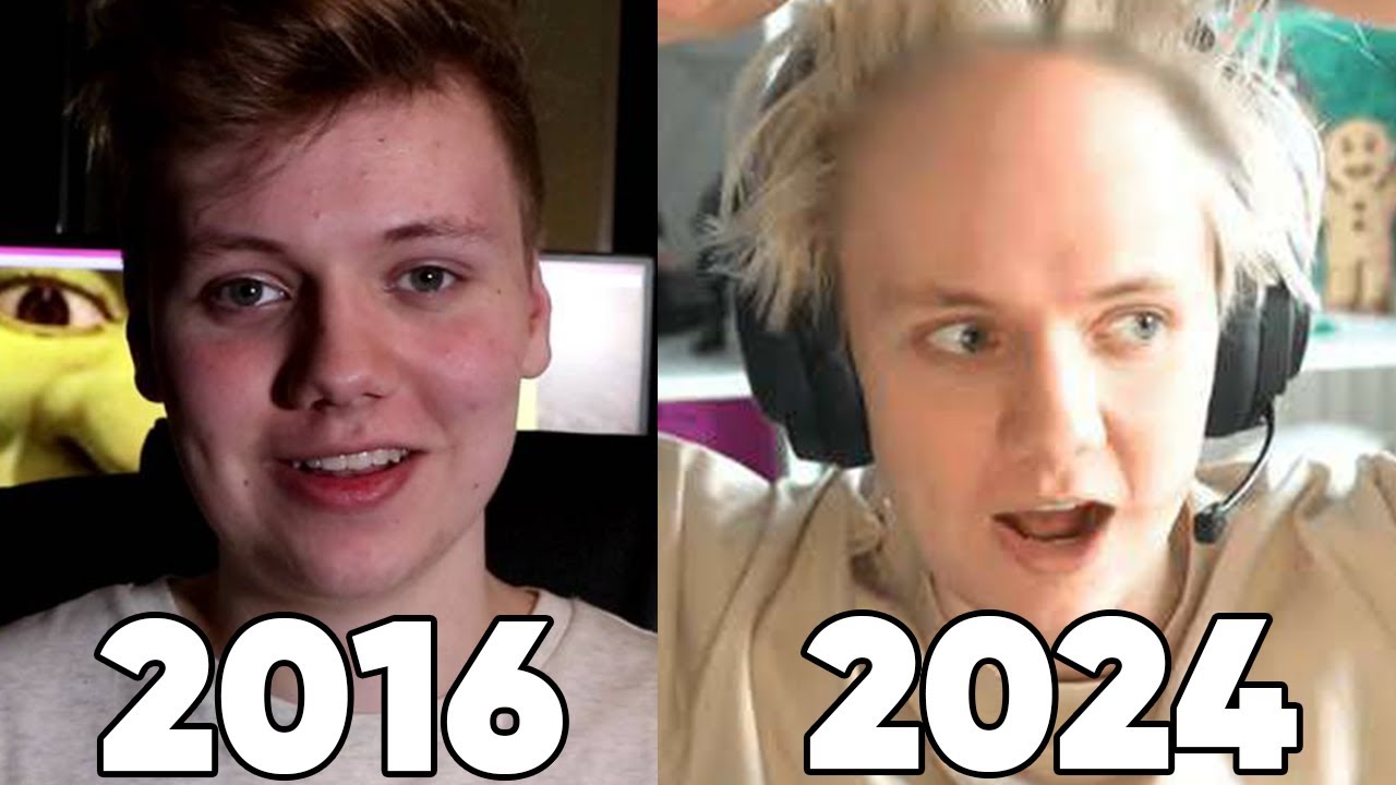 is Pyrocynical actually balding?