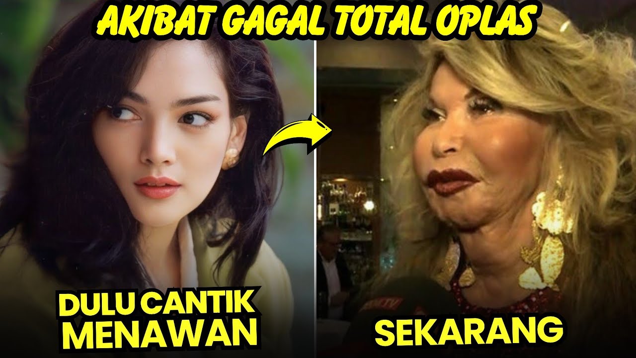 DULU JADI PRIMADONA, WAJAH 8 ARTIS INI KINI BERUBAH DRASTIS AKIBAT GAGAL OPLAS