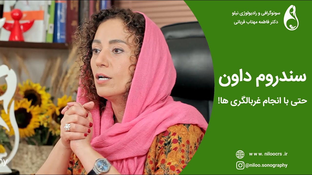 عدم تشخیص سندروم داون