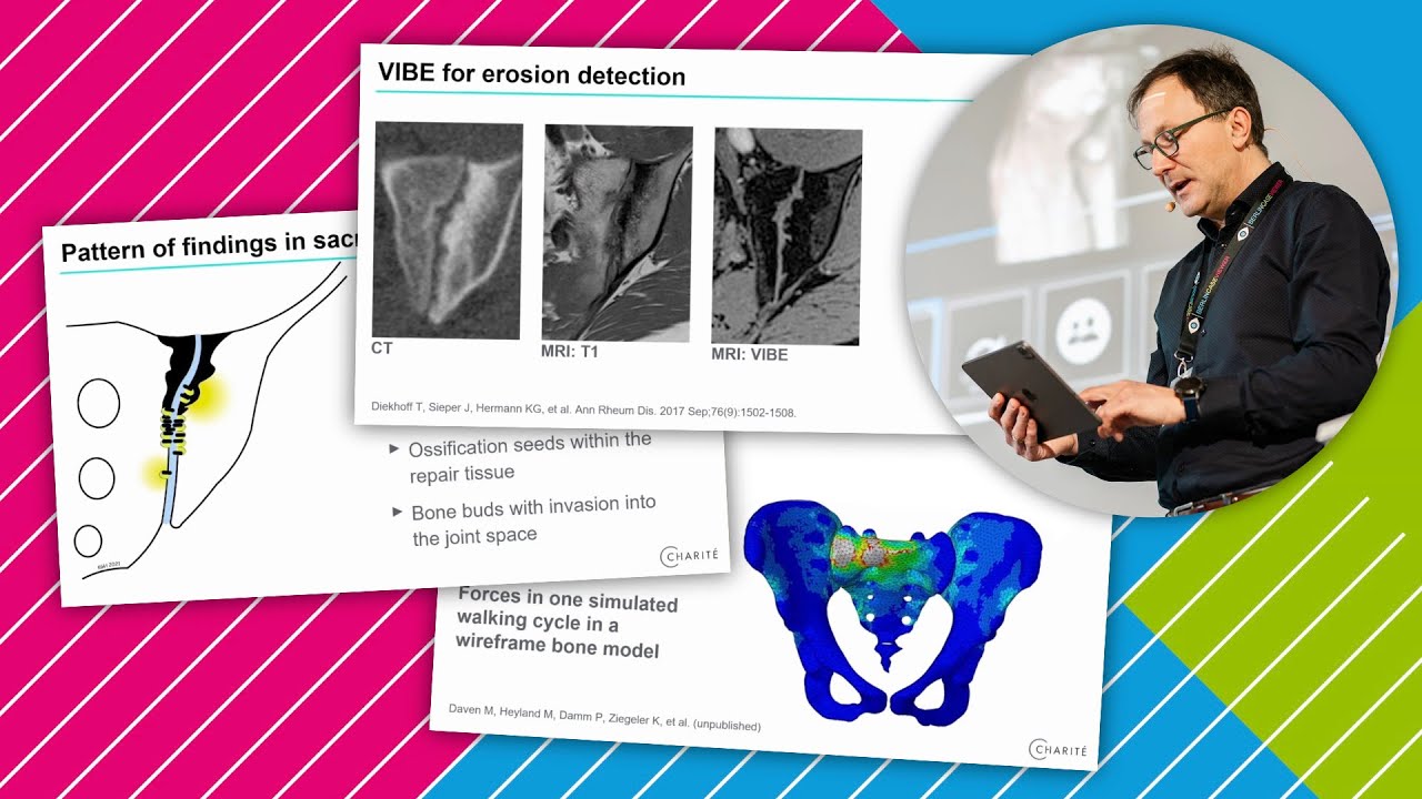 Advanced imaging of spondyloarthropathies*: What is new? // *aka Spondyloarthritis