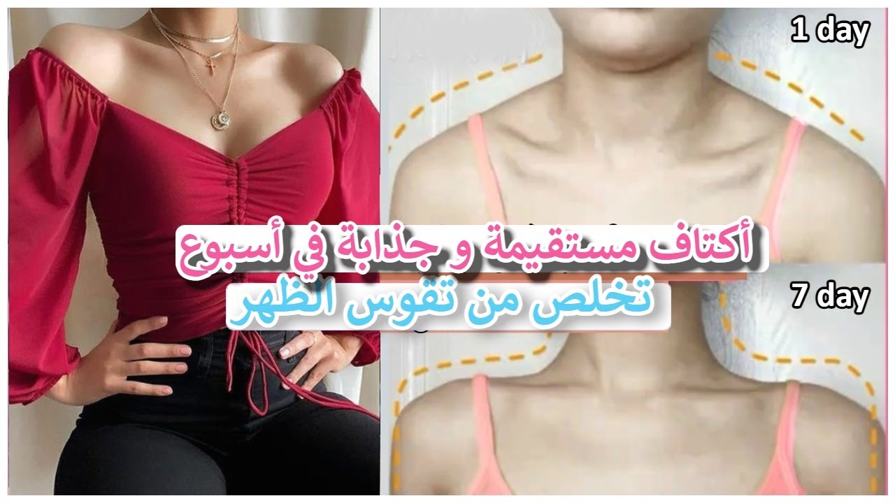 تمارين للحصول على رقبة و أكتاف مستقيمة 🍃 تمارين تعدل تقوس الظهر