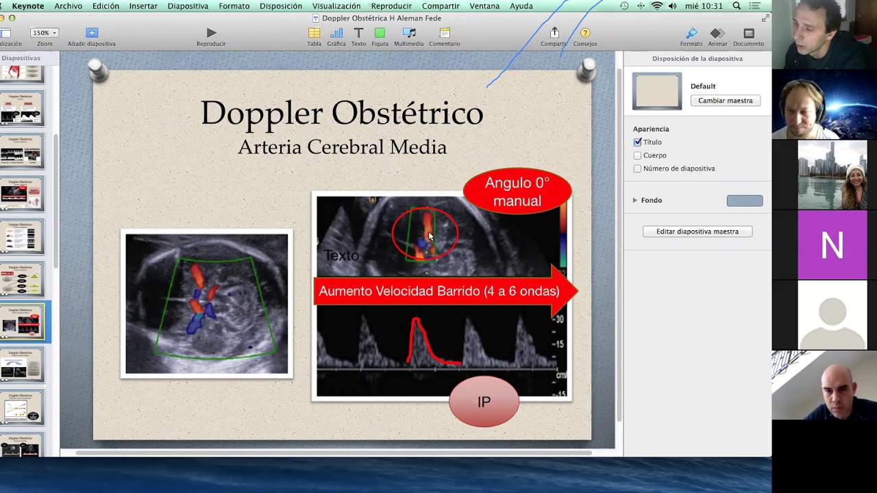 Doppler Obstétrico