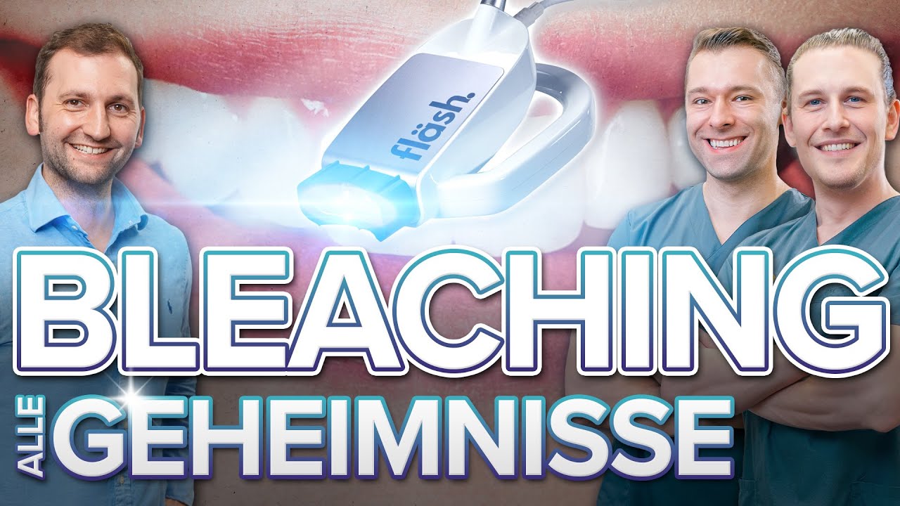 Zahnbleaching erklärt - Genauer Ablauf + Risiken und Gefahren? Top 10 Fragen zur Zahnaufhellung