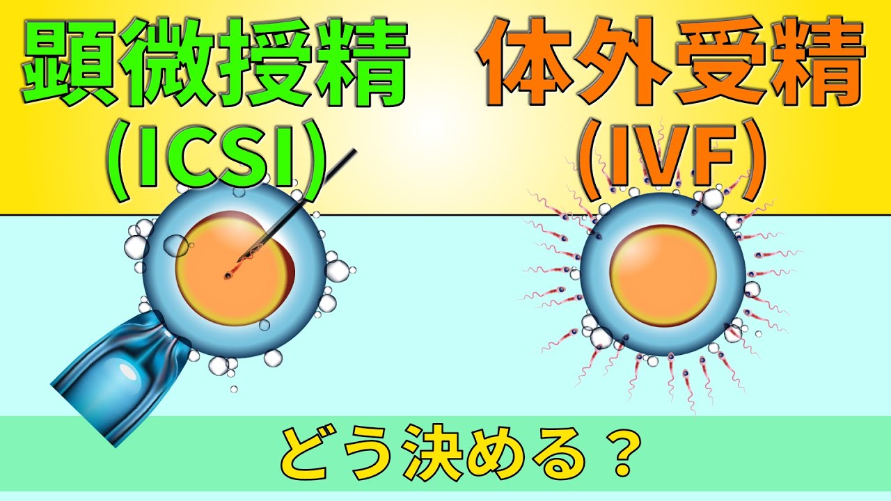 13.【受精】体外受精と顕微受精の違いは？さらに先進的な方法も　(2022.8.29版)