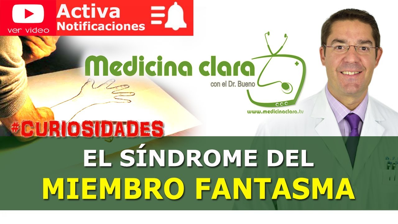 Síndrome del miembro fantasma | Curiosidades médicas en Medicina Clara