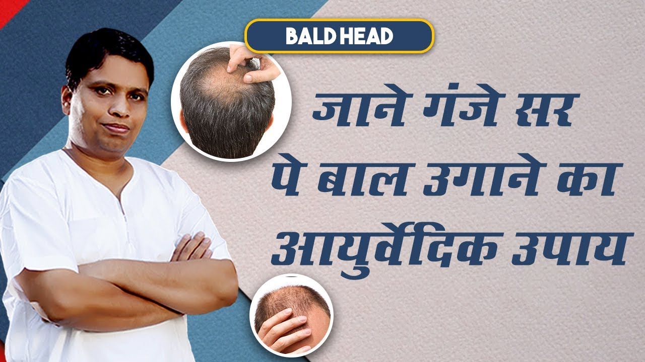 जाने गंजे सर (Bald Head) पे बाल उगाने का आयुर्वेदिक उपाय | Acharya Balkrishna