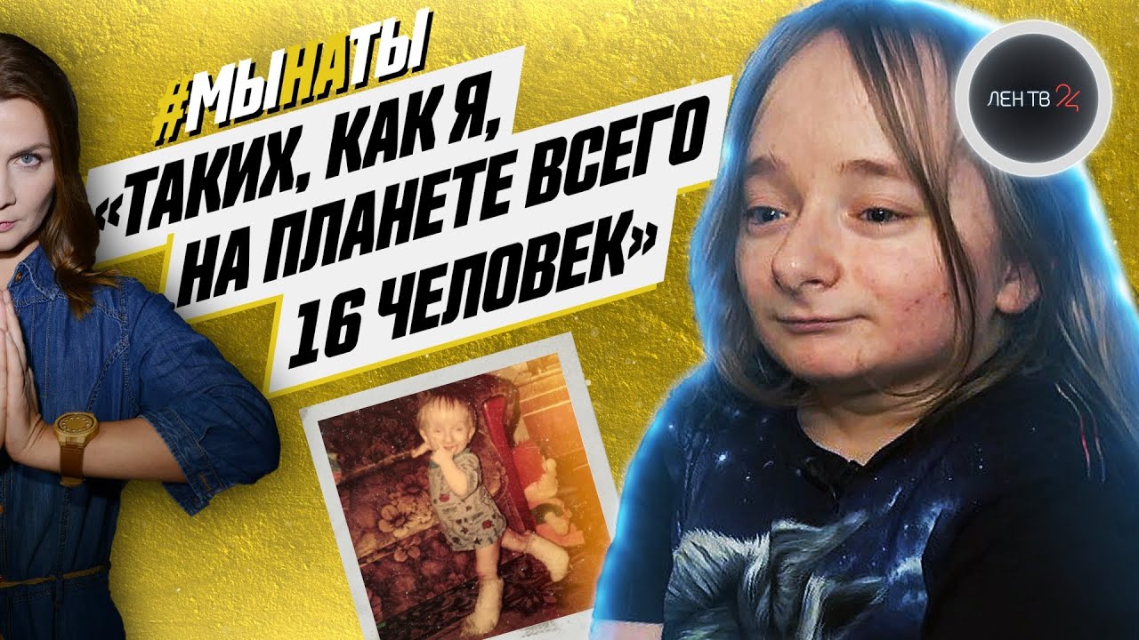 Как жить с самым редким заболеванием в мире? | Синдром Саула-Вильсона | Эльвира Цветкова | #мынаты